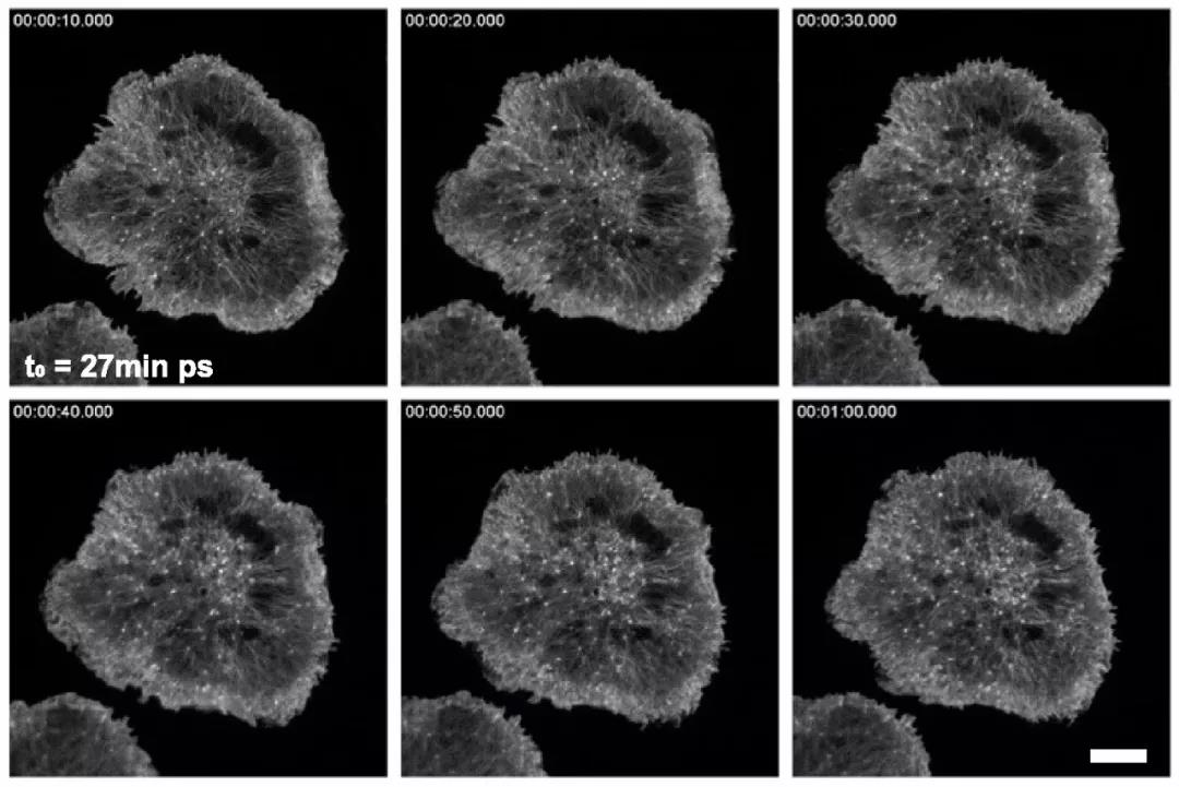 科学家首次证实肌动蛋白的纳米级动力学对杀伤细胞分泌裂解性颗粒至关重要