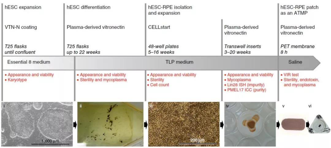 胚胎干细胞来源的视网膜色素上皮细胞贴片成功治愈老年性黄斑变性